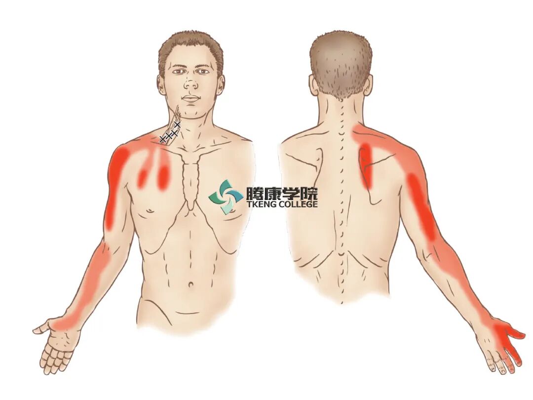 呼吸疼痛9块肌肉 疼痛康复研究 微信公众号文章阅读 Wemp