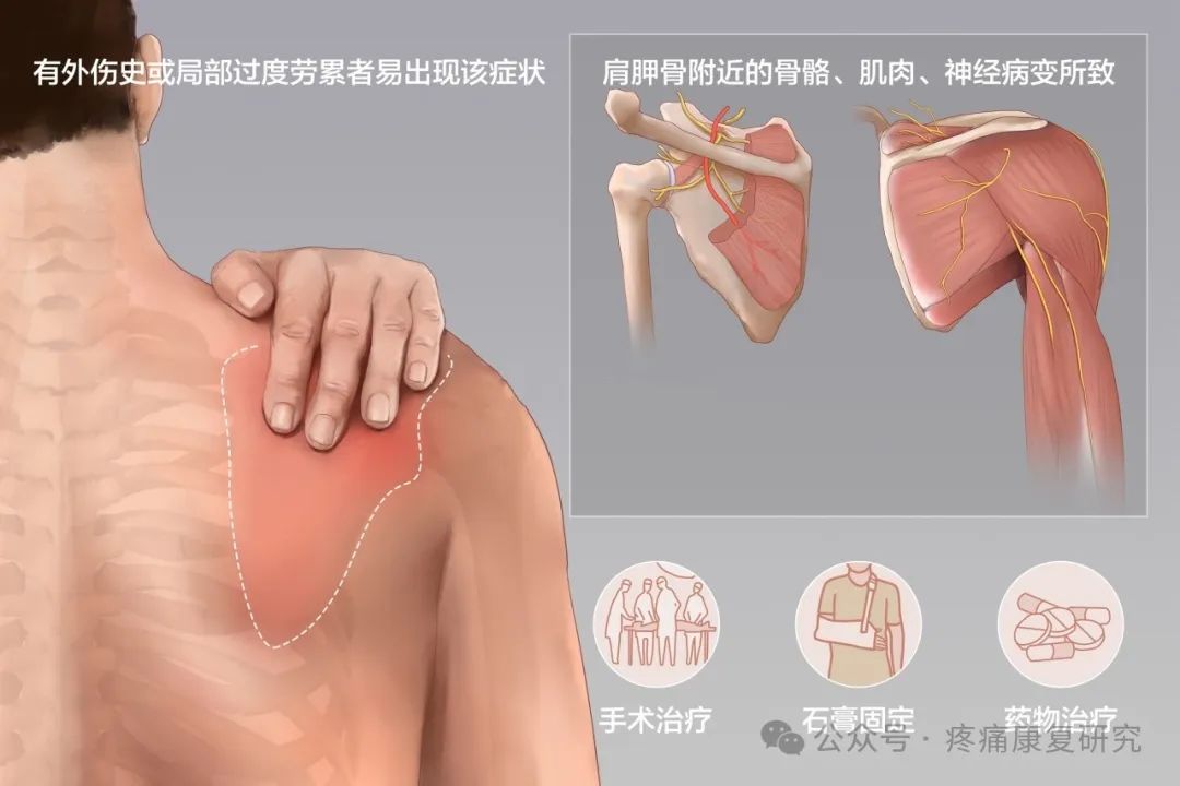 肩胛骨疼痛的 9 种病因和 7 种治疗