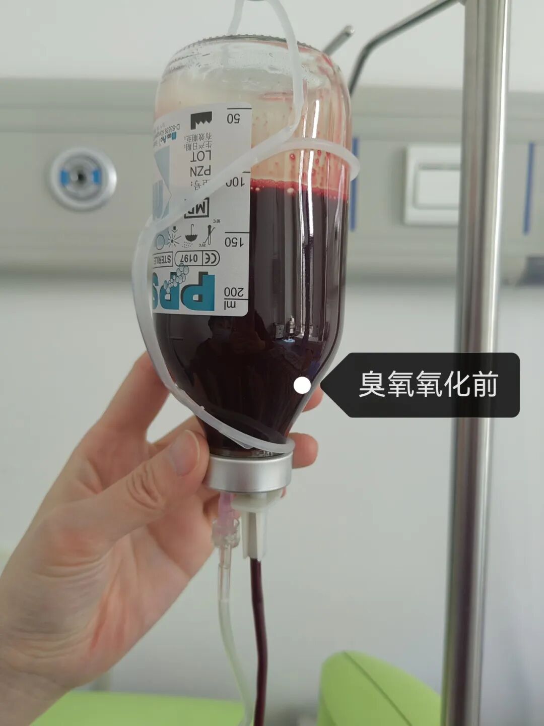 什么是臭氧大自血疗法健康科普 ｜ 三氧大自血疗法：以己之血，治己之病_https://www.jmylbn.com_新闻资讯_第4张