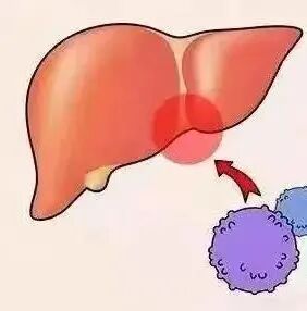 什么是臭氧大自血疗法健康科普 ｜ 三氧大自血疗法：以己之血，治己之病_https://www.jmylbn.com_新闻资讯_第14张