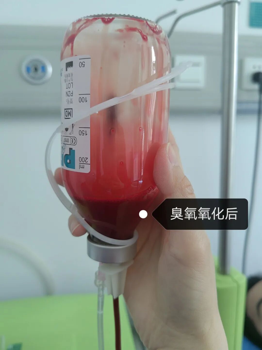 什么是臭氧大自血疗法健康科普 ｜ 三氧大自血疗法：以己之血，治己之病_https://www.jmylbn.com_新闻资讯_第5张