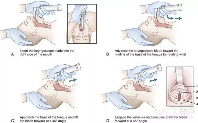 监护仪怎么使用【干货】汇集常用急救设备的使用_https://www.jmylbn.com_新闻资讯_第44张