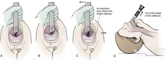 监护仪怎么使用【干货】汇集常用急救设备的使用_https://www.jmylbn.com_新闻资讯_第45张
