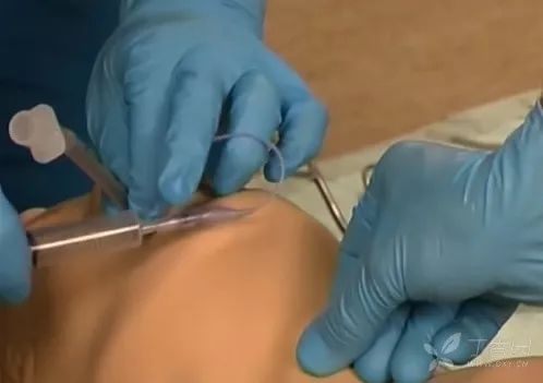 监护仪怎么使用【干货】汇集常用急救设备的使用_https://www.jmylbn.com_新闻资讯_第47张