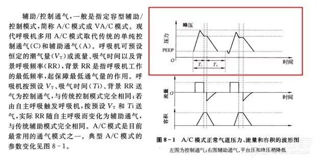 bipap英语怎么读课本竟然讲错了？难怪学不会呼吸机_https://www.jmylbn.com_新闻资讯_第11张