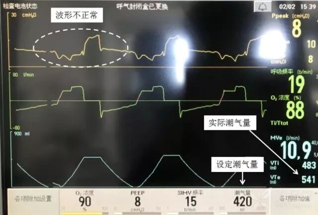 bipap英语怎么读课本竟然讲错了？难怪学不会呼吸机_https://www.jmylbn.com_新闻资讯_第8张