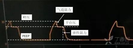 bipap英语怎么读课本竟然讲错了？难怪学不会呼吸机_https://www.jmylbn.com_新闻资讯_第10张