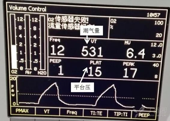 bipap英语怎么读课本竟然讲错了？难怪学不会呼吸机_https://www.jmylbn.com_新闻资讯_第5张