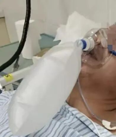 制氧机面罩怎么用普通面罩和储氧面罩有何区别？关于「面罩和氧疗」的 5 问 5 答_https://www.jmylbn.com_新闻资讯_第4张