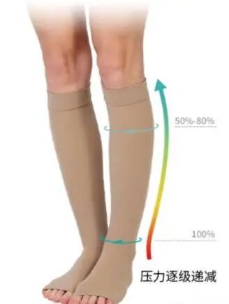 医用弹力袜用什么洗科普新知 ｜ 别误会，它只是看着很像丝袜......_https://www.jmylbn.com_新闻资讯_第5张