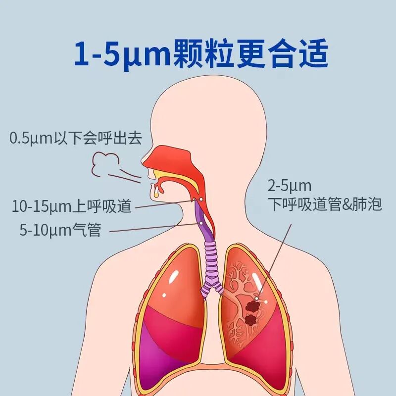 医用雾化器怎么用咳嗽雾化很有用，但雾化器却不能乱选！_https://www.jmylbn.com_新闻资讯_第2张
