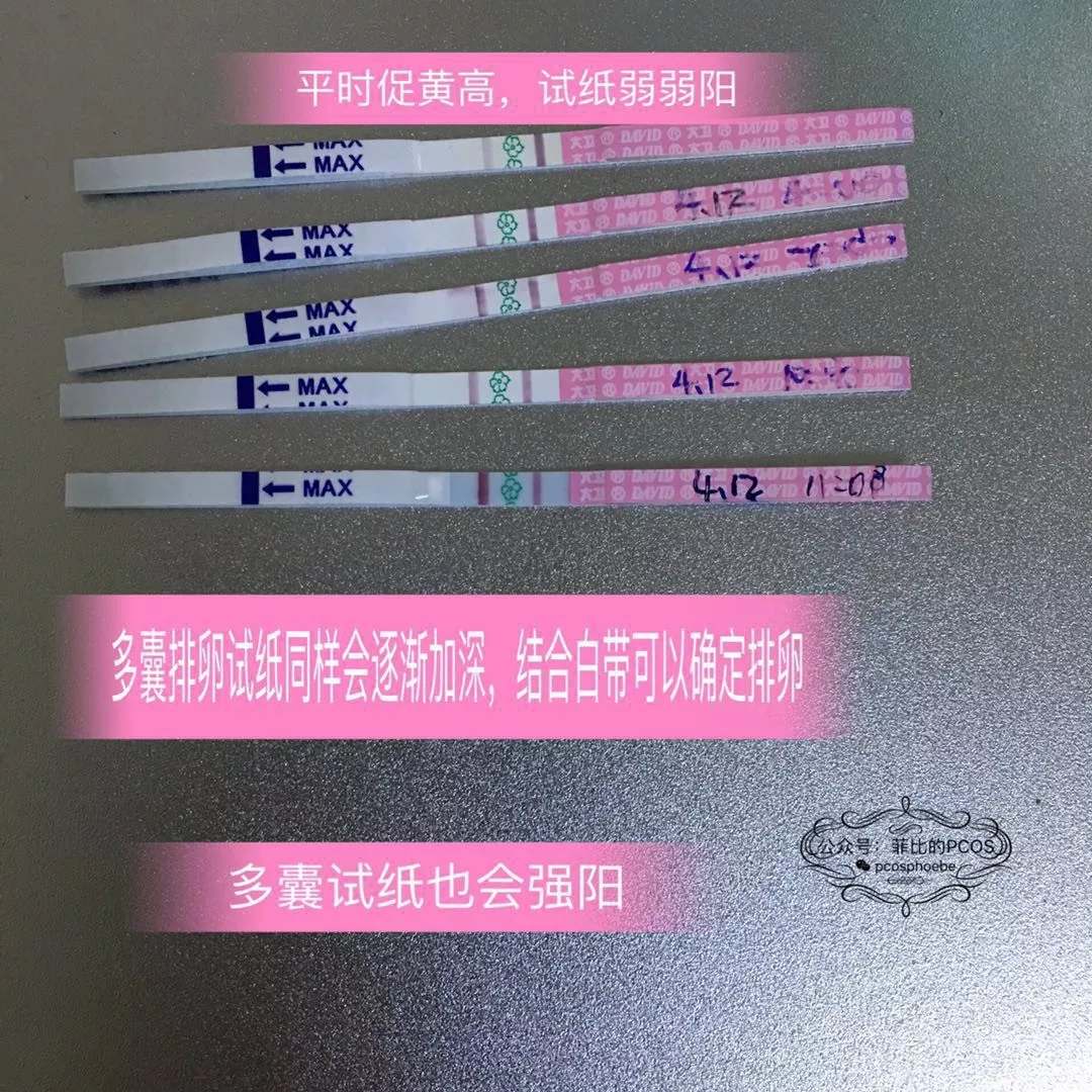 排卵试纸对多囊没用吗 菲比的pcos