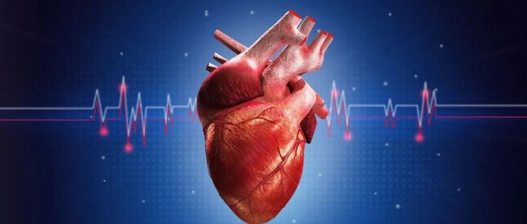 早读 | 急诊PCI术中无复流的防治策略，干货值得学习！