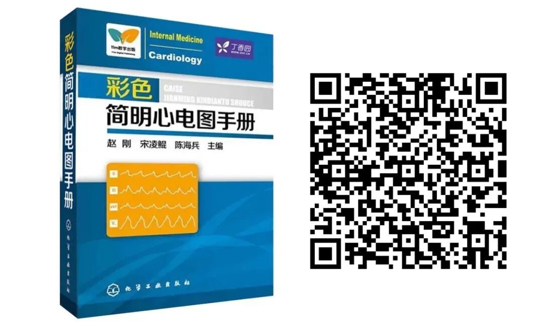 床旁心电图怎么做预售 ｜ 床旁临时心脏起搏手册，手把手教会起搏技术！_https://www.jmylbn.com_新闻资讯_第31张