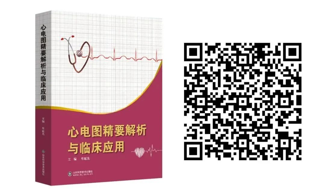 床旁心电图怎么做预售 ｜ 床旁临时心脏起搏手册，手把手教会起搏技术！_https://www.jmylbn.com_新闻资讯_第32张