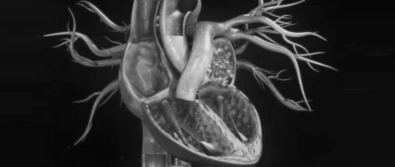 早读 | 当你拿到一份CT报告，要特别注意哪些征象？