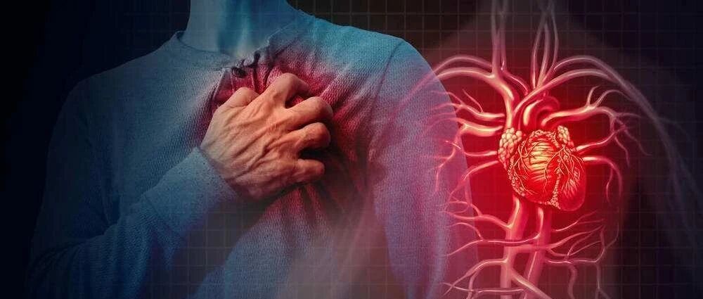 早读 | 非ST段抬高型急性冠脉综合征，总结全了！