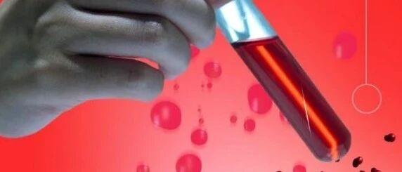 早读 | BNP与NT-proBNP，诊断心衰孰优孰劣？