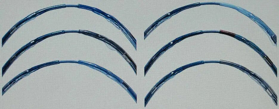 球囊是什么医疗器械一文看懂医用球囊技术知识_https://www.jmylbn.com_新闻资讯_第8张