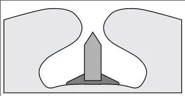 球囊是什么医疗器械一文看懂医用球囊技术知识_https://www.jmylbn.com_新闻资讯_第19张