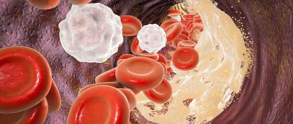 早读 | 常用血脂检测指标及临床意义，这篇帮你搞定！