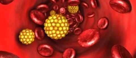 早读 | 全面解读血脂四项，这些数值都记清楚了吗？