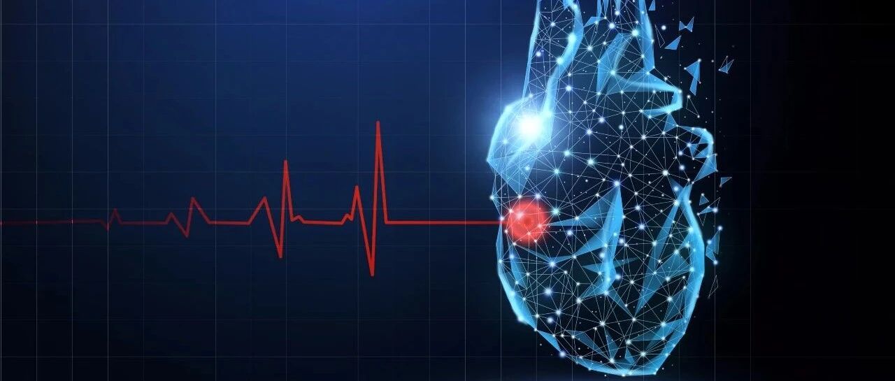 早读 | 2021ESC心衰指南更新：SGLT-2i正式上位，“金三角”变新策略！