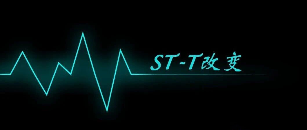 早读 | 万字长文，道尽『ST-T改变』的种种困惑！