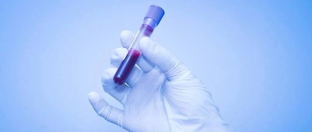 早读 | BNP与NT-proBNP有什么区别？