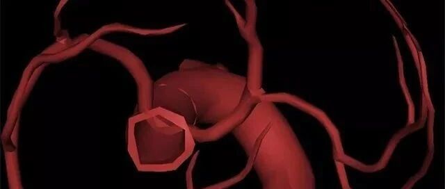 早读 | 高清3D图片，轻松理解冠脉造影体位！