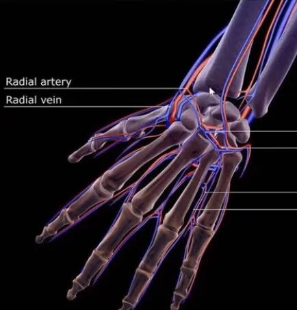 桡动脉穿刺技巧，你要知道的细节都在这！