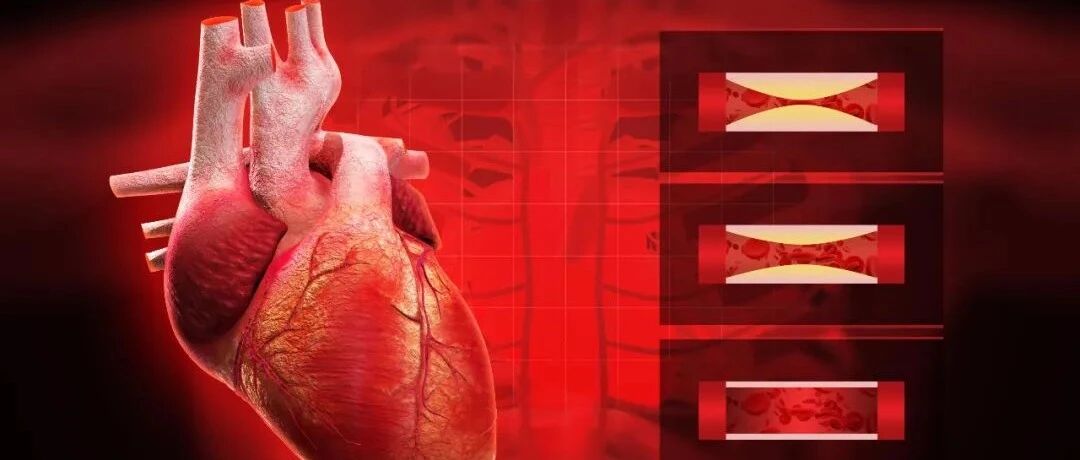 早读 | 易损斑块的识别，这些冠脉影像学技巧帮你搞定！