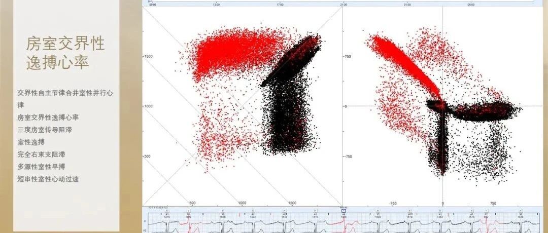 早读 | 如何阅读24小时动态心电图？这篇一定要收藏！