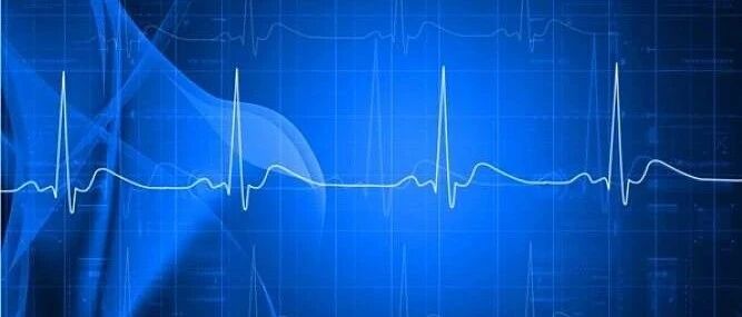 早读 | 如何快速阅读心电图？记住这四步让你事半功倍！