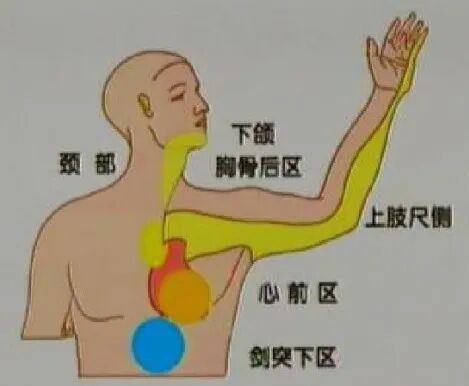 太全了！急性心梗的识别与处理，赶紧存起来