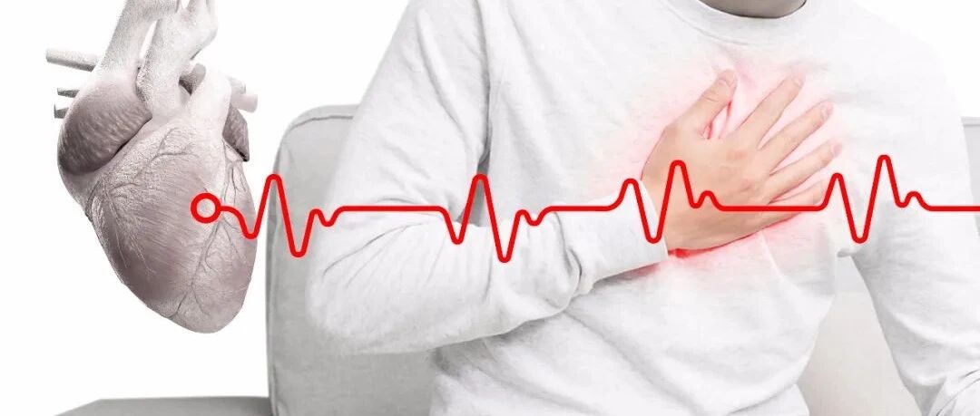 早读 | ST-T改变，除了心梗你还能想到多少种原因？