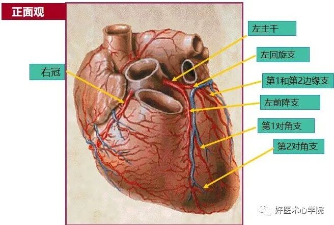 造影导丝是什么珍藏 冠脉造影从流程到诊断，基础必备！_https://www.jmylbn.com_新闻资讯_第6张
