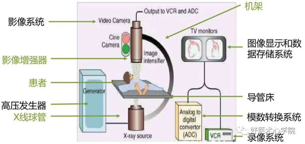 造影导丝是什么珍藏 冠脉造影从流程到诊断，基础必备！_https://www.jmylbn.com_新闻资讯_第12张