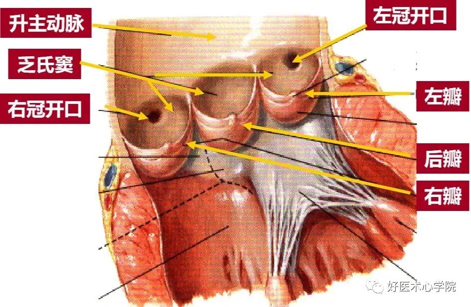 造影导丝是什么珍藏 冠脉造影从流程到诊断，基础必备！_https://www.jmylbn.com_新闻资讯_第9张