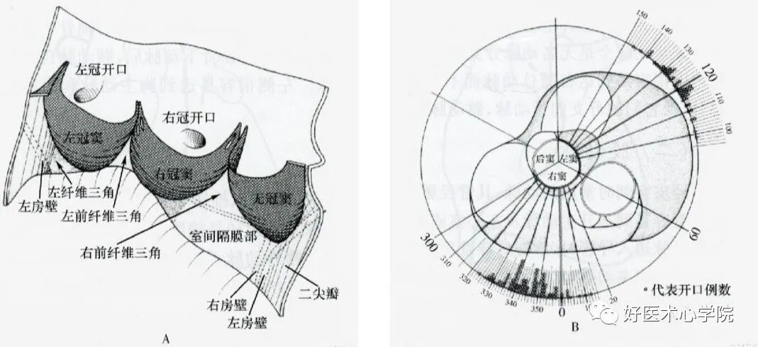 造影导丝是什么珍藏 冠脉造影从流程到诊断，基础必备！_https://www.jmylbn.com_新闻资讯_第10张