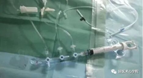 造影导丝是什么珍藏 冠脉造影从流程到诊断，基础必备！_https://www.jmylbn.com_新闻资讯_第17张