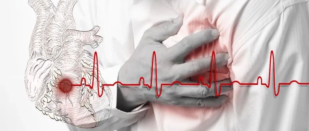 早读 | 急诊心电图识别精要（PPT），推荐收藏！