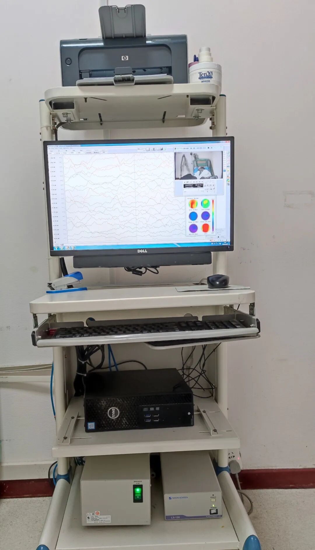 日本光电脑电图怎么样“会说话”的脑电图告诉您为什么宝宝经常四肢抖动_https://www.jmylbn.com_新闻资讯_第6张
