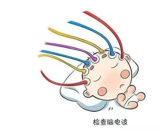 日本光电脑电图怎么样“会说话”的脑电图告诉您为什么宝宝经常四肢抖动_https://www.jmylbn.com_新闻资讯_第2张