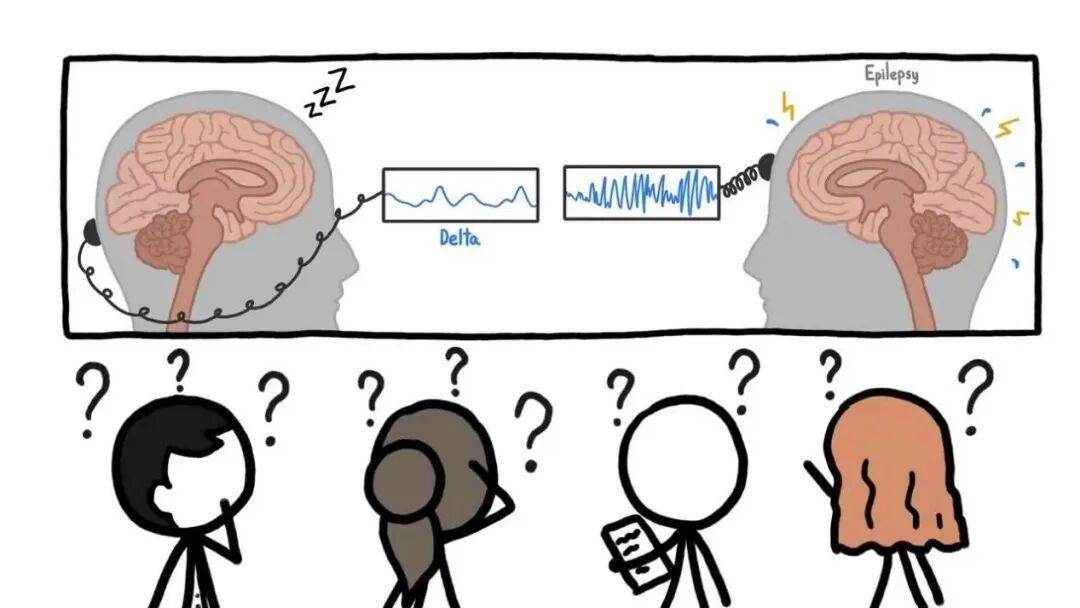 日本光电脑电图怎么样“会说话”的脑电图告诉您为什么宝宝经常四肢抖动_https://www.jmylbn.com_新闻资讯_第4张