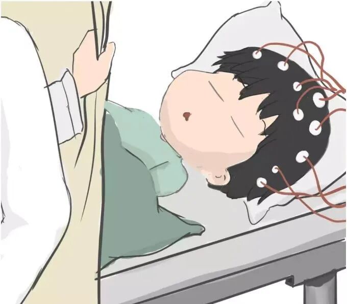 日本光电脑电图怎么样“会说话”的脑电图告诉您为什么宝宝经常四肢抖动_https://www.jmylbn.com_新闻资讯_第9张