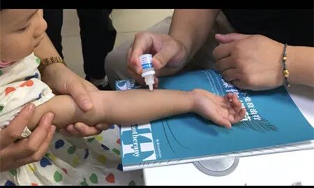 医院儿童病床为什么高对过敏说“再见”——永煤总医院儿科开展过敏原试验及治疗_https://www.jmylbn.com_新闻资讯_第22张