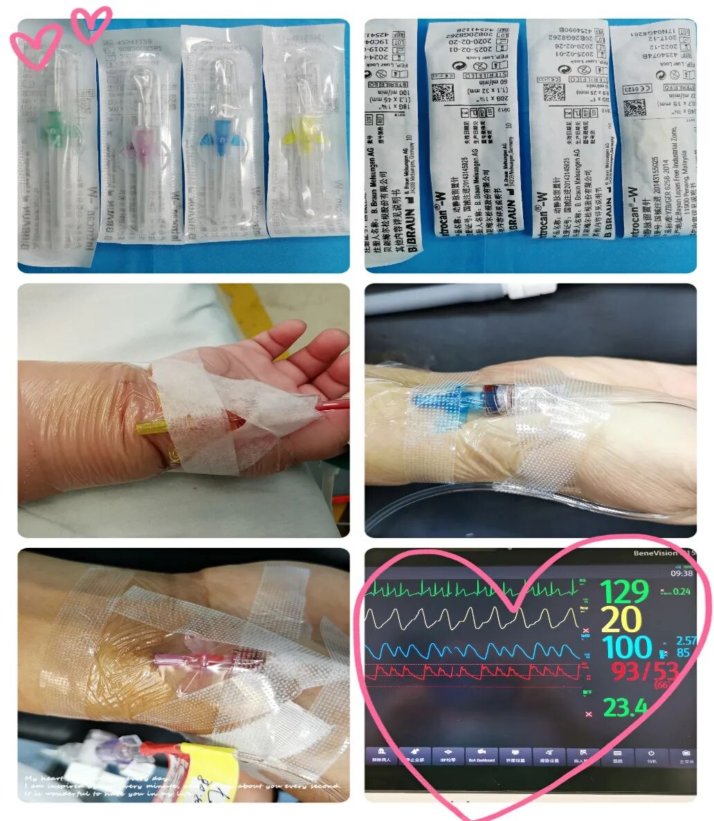 为什么输血不能用小针麻醉针上艺术——可可糖麻醉科普系列（四）_https://www.jmylbn.com_新闻资讯_第9张