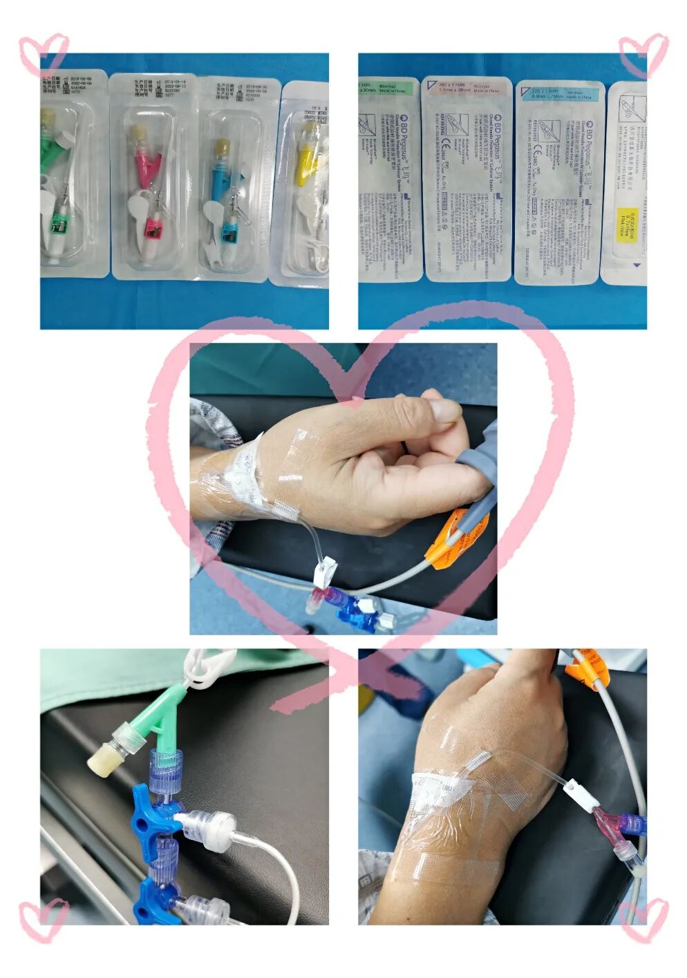 为什么输血不能用小针麻醉针上艺术——可可糖麻醉科普系列（四）_https://www.jmylbn.com_新闻资讯_第8张