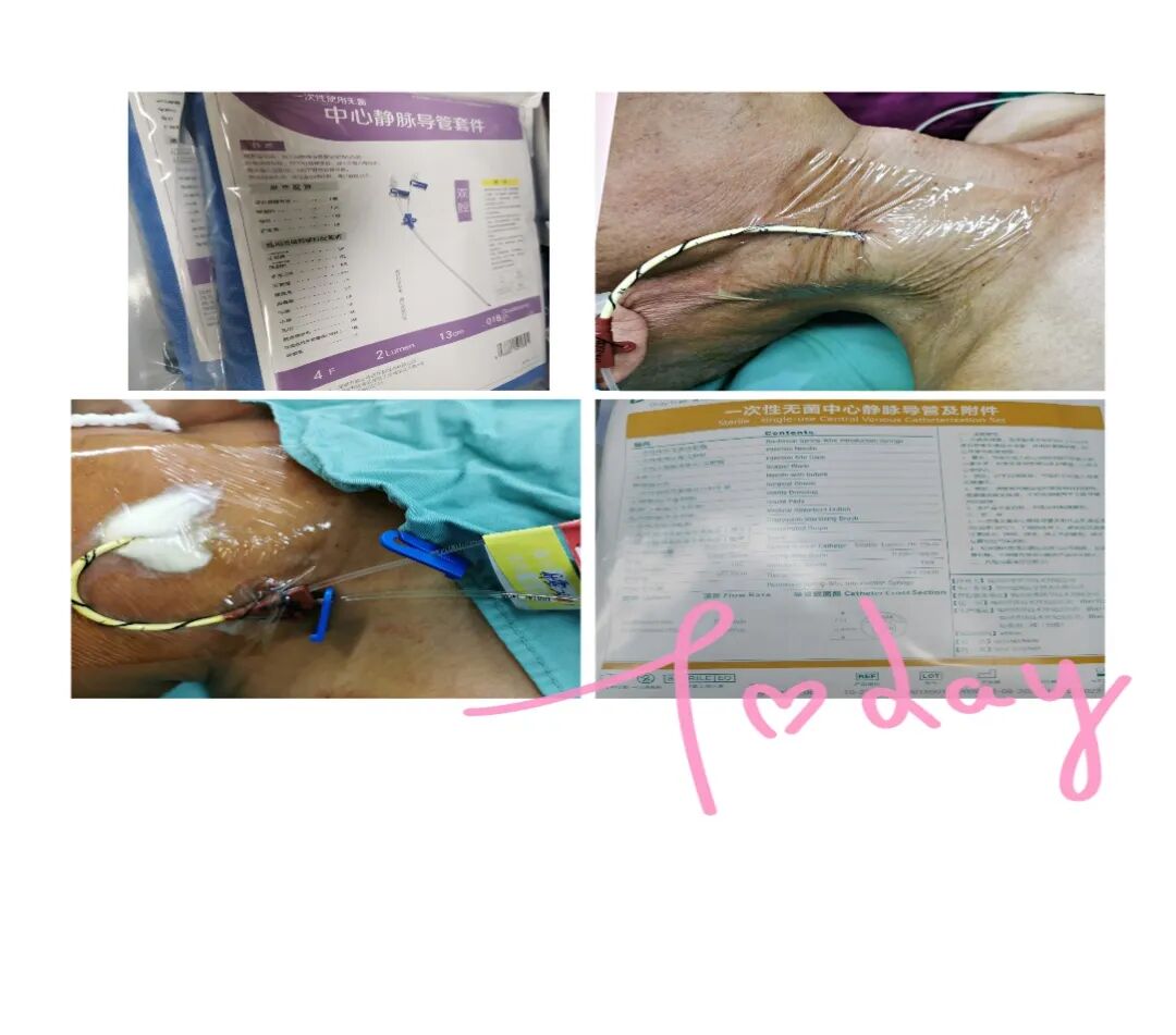 为什么输血不能用小针麻醉针上艺术——可可糖麻醉科普系列（四）_https://www.jmylbn.com_新闻资讯_第10张